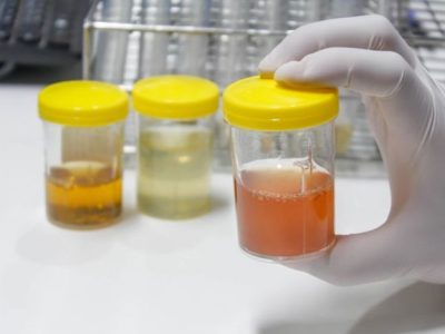 Bibit Unggul Pinang