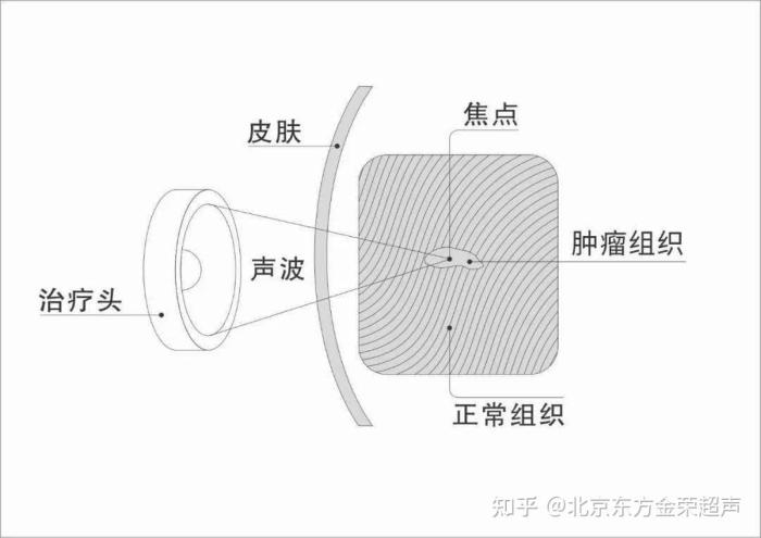Gambas Prima F1